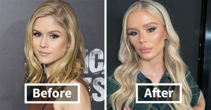 Did Constance Nunes Get Plastic Surgery? Everything We Know About The TV Personality