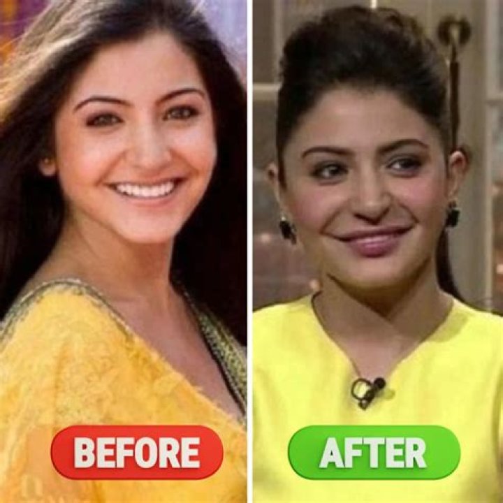 Who Is Doresani Chethana Raj? 21 Year Old Actress Becomes Death Victim Of Plastic Surgery Gone Wrong